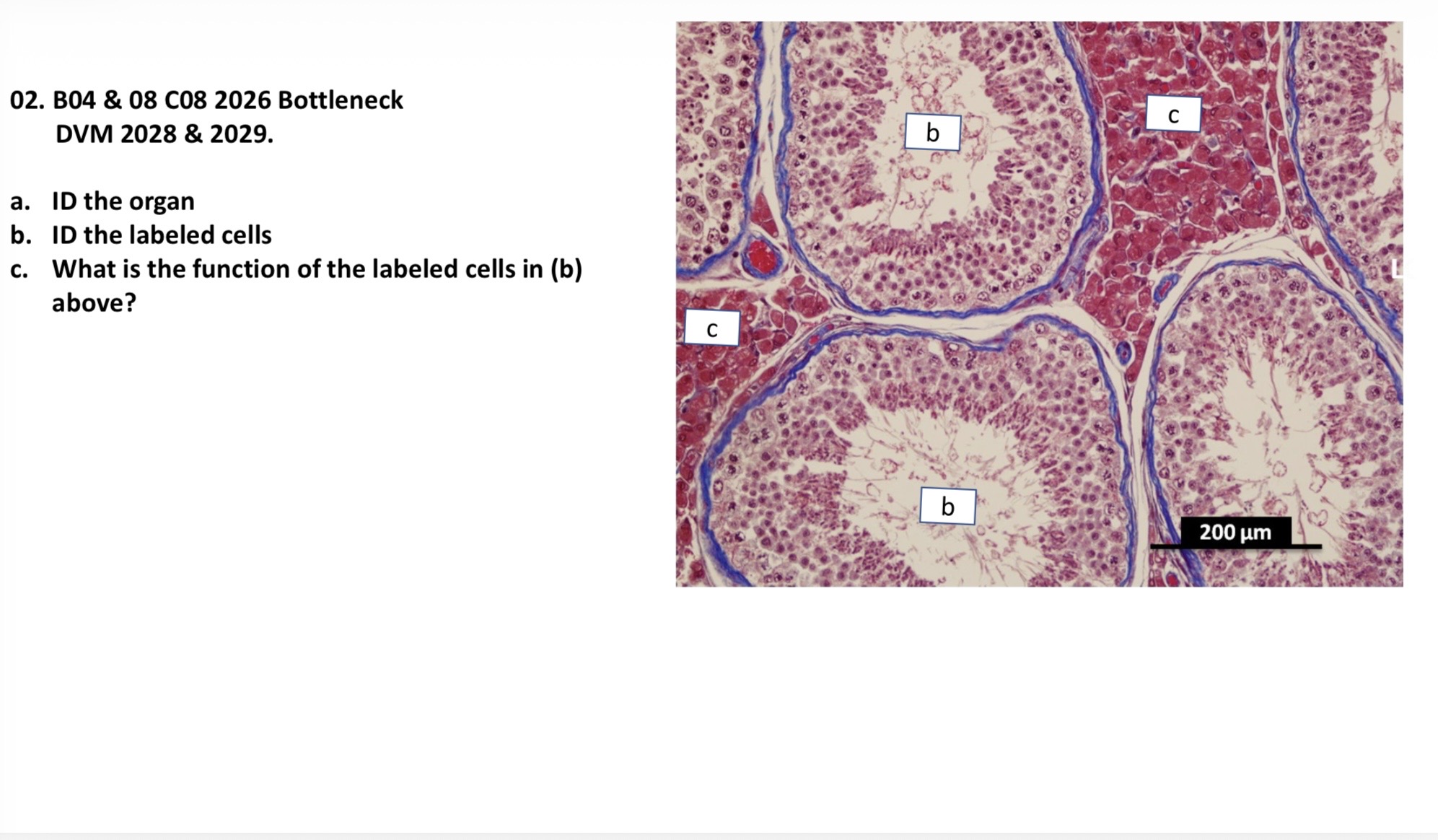 <p>A. ID the organ </p><p>B. ID the labeled cells</p><p>C. What is the function of the labeled cells in (b) above? </p>