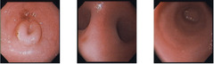 <p>What are you seeing in these images in a female camelid?</p>