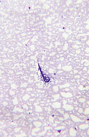 sheathed, nuclei extends to the tip of the tail in a continuous row, the sheath does not stain showing a ghost image