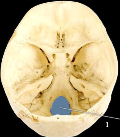 <p>Name This Foramen</p>