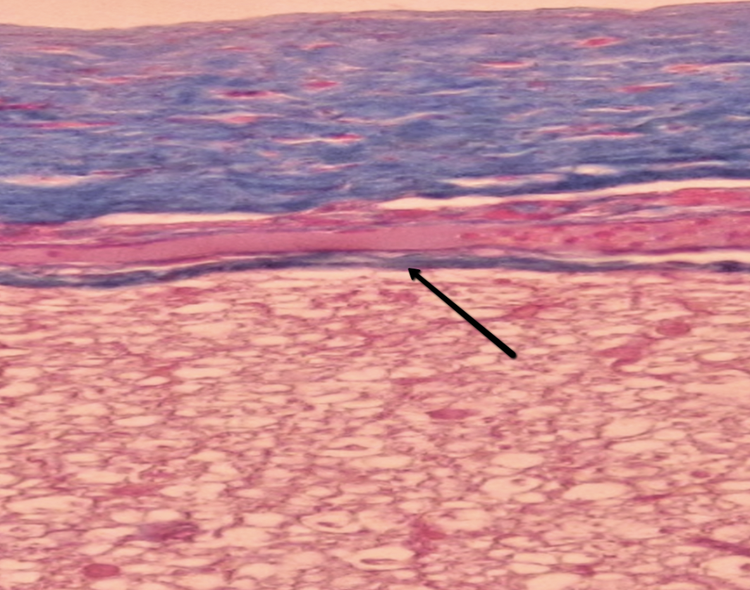 <p><span>Identify the thin dark structure/layer indicated by the pointer.</span></p>