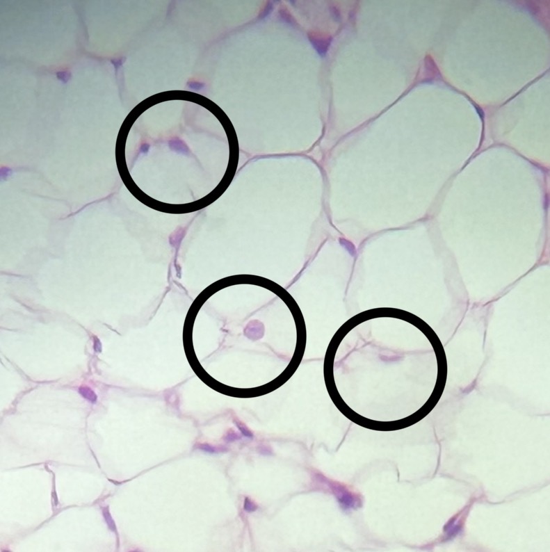 <p>This tissue lines the vestibule and makes up part of the serosa/adventitia. The cells of this tissue are also refered to as Type I alveolar cells.</p>