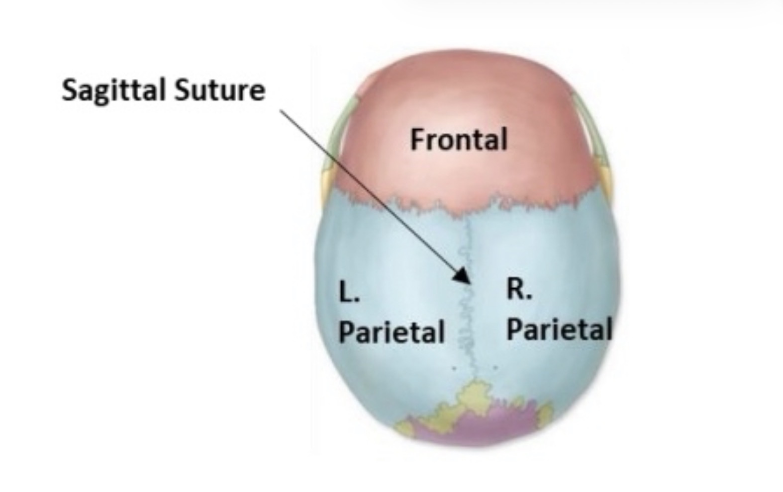 <p>sagittal suture</p>