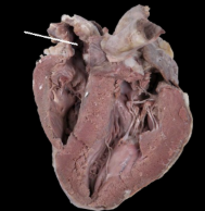 <p><span style="line-height: 17.375px;">Identify the Chamber&nbsp;</span></p>