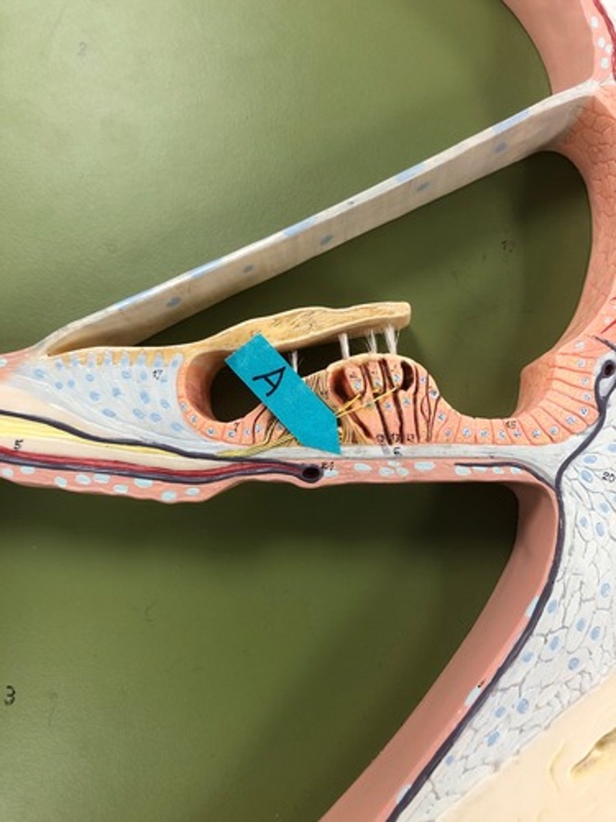 <p>Identify this structure.</p>