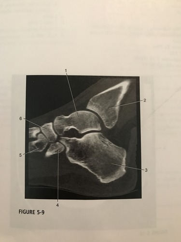 <p>Number 4 corresponds to which of the following?</p><p>A) navicular</p><p>B) cuboid</p><p>C) calcaneus</p><p>D) talus</p>