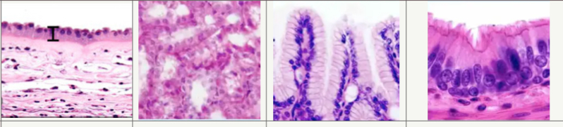 <p>What are 4 types of <strong><u>simple epithelial tissue</u></strong> (non-keratinized)</p>