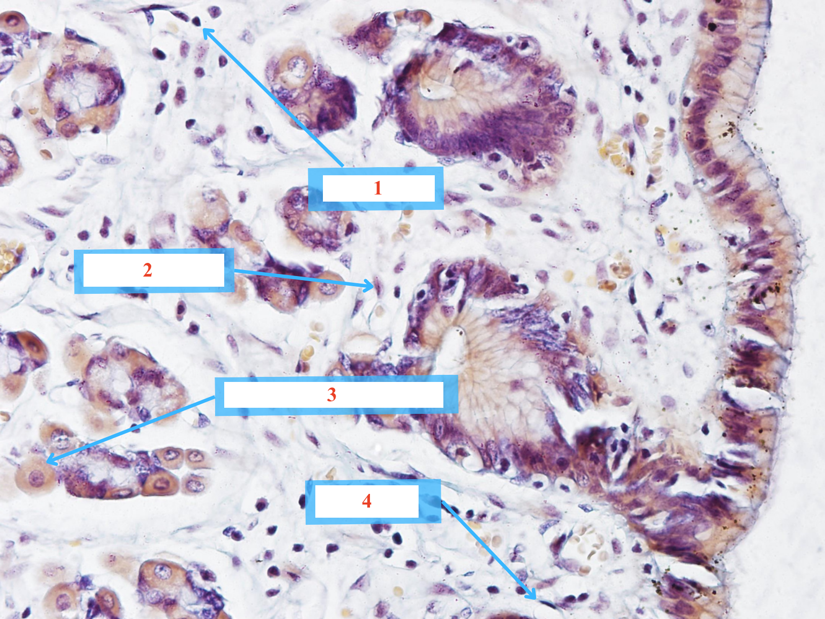 <p>Tế bào gì ?</p>