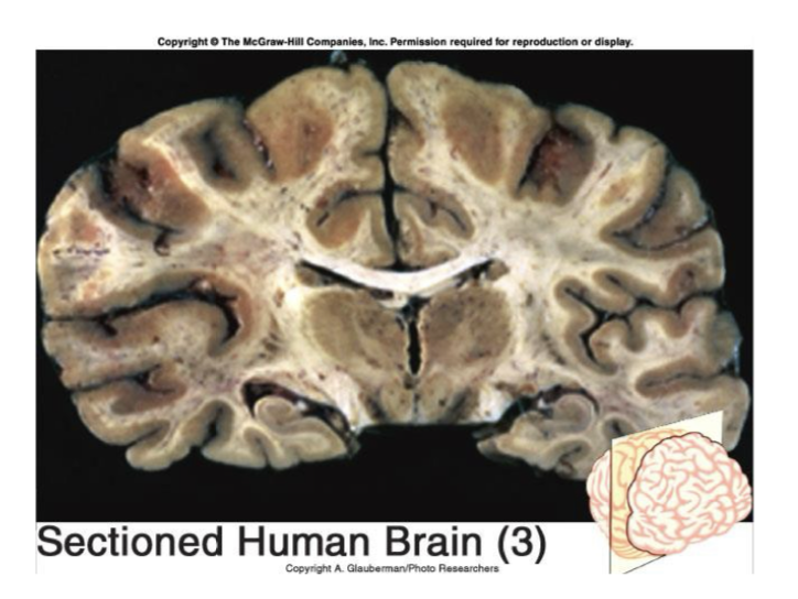 <p>Divides the body into anterior and posterior</p>