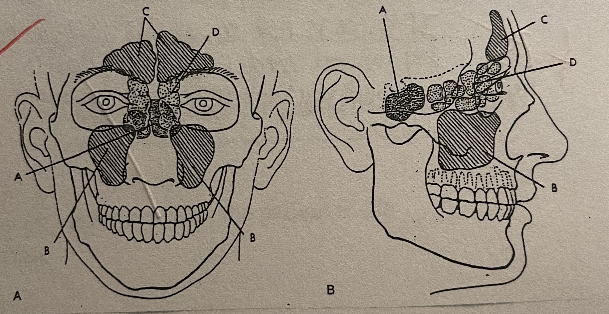 <p>Label the following sinus anatomy:</p>