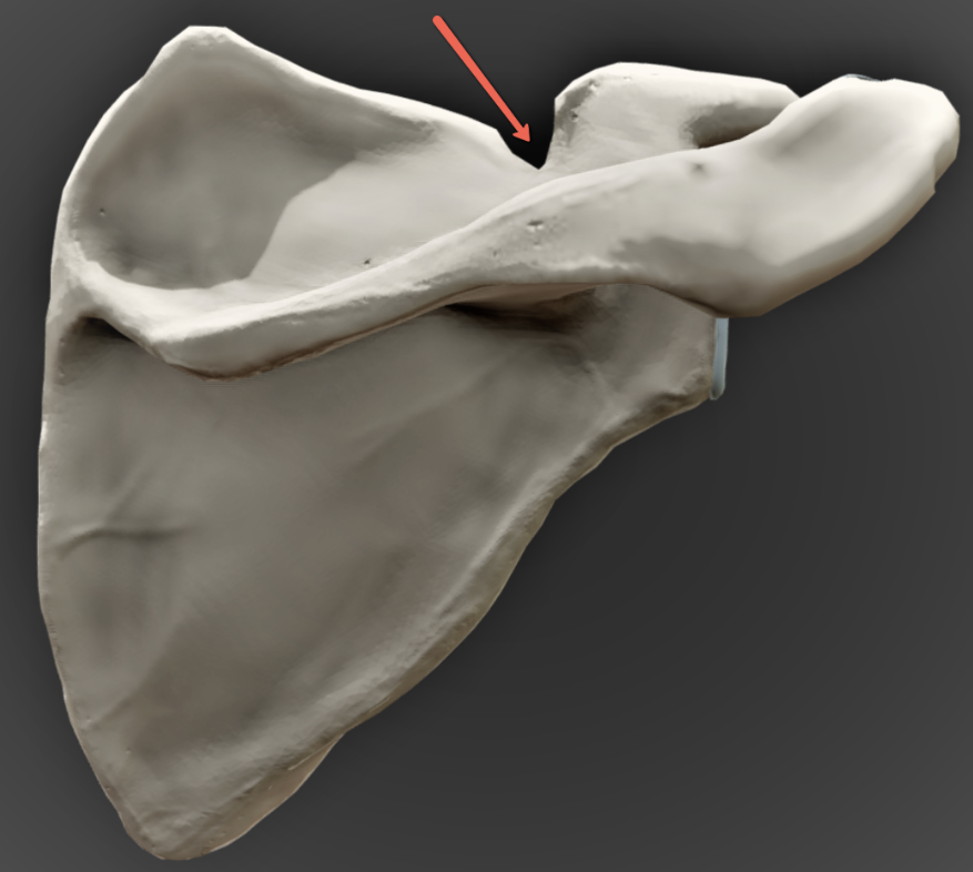 <p><span><strong>Identify the bone marking indicated by the pointer.</strong></span></p>