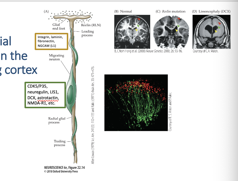 <p><span style="font-family: "Calibri Light";"><strong>22.14 Radial migration in the developing cortex</strong></span></p>