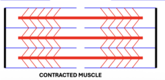 <p>Muscle Contracts and Shortens</p>