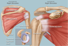 <p>surgery was needed to repair the torn tendon</p>