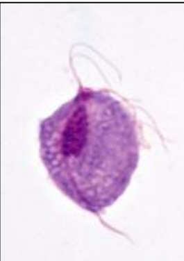 <p>Identifique e indique o tratamento da doença</p>