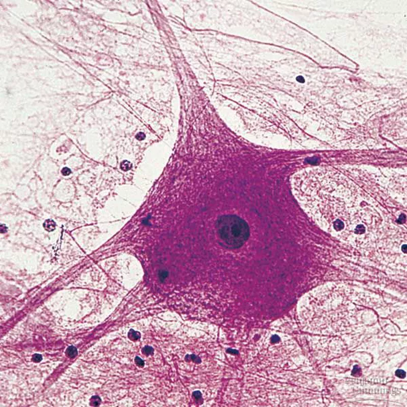 <p>What is the following tissue? What is the center and the branches coming off it called?</p>