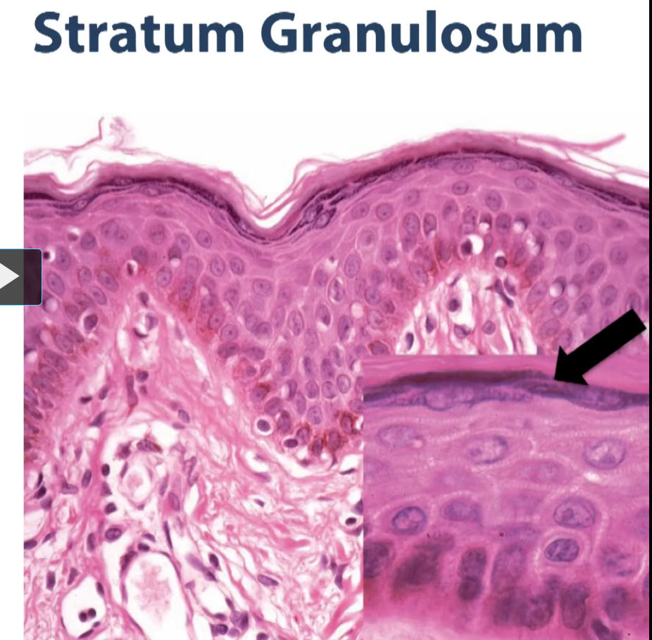 <p>so, if we move <strong>down </strong>from the keratinized layer, the next layer that we would see below would be the granular layer or the stratum granulosa. The stratum granulosum contains these granules, that are called keratohyalin granules, and the material in these granules are exocytosed and it’s this lipid like substance that creates a barrier against moisture adding and moisture prevent and moisture loss within the skin. Those granules, synthesized by these cells, give these layers</p>