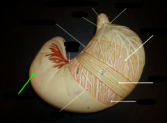 <p>What structure is the green arrow pointing to?</p>