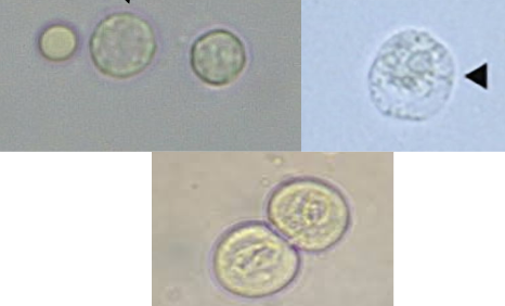 <p>What kind of cell is this? Describe how it looks & what “normal” is. <br>How do you report these cells (what power and how many)?</p><p><br>If they are found to be >5 in urine, what is this called? What diseases are they associated with? </p>