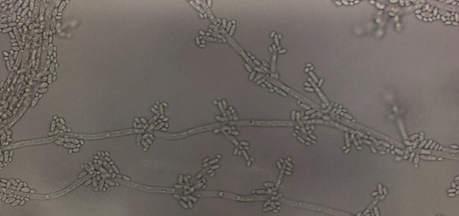 <p>“cross-matchstick” </p>