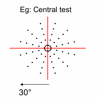 <p>Medmont uses a <strong>radial </strong>pattern </p><p>Patterns specified as: </p><ul><li><p>Macular = 10° </p></li><li><p>Central = 30° </p></li><li><p>Glaucoma = central 30°and out to 50° nasally </p></li><li><p>Peripheral = 50°</p></li></ul><p></p>