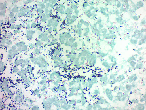 <p>Gram</p>