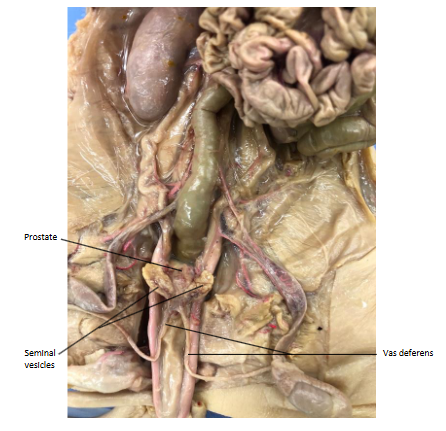 <p>Located under the urinary bladder, they secrete an alkaline viscous fluid that is needed to neutralize the acidic female environment. The fluid is high in fructose to supply sperm with ATP</p>