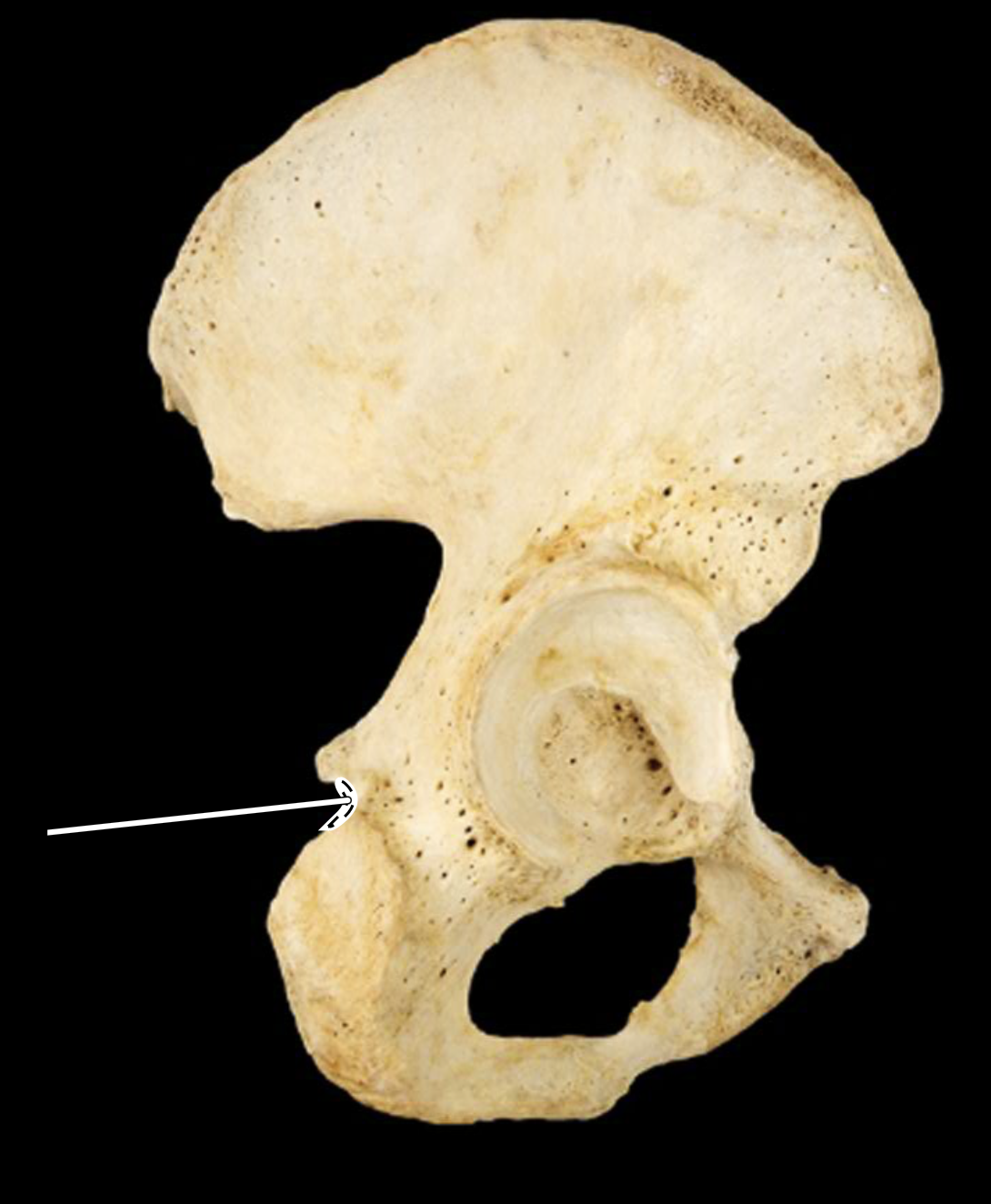 <p>lateral view, right side</p>
