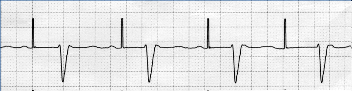 <p>what waveform is this</p>