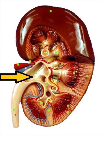 term image