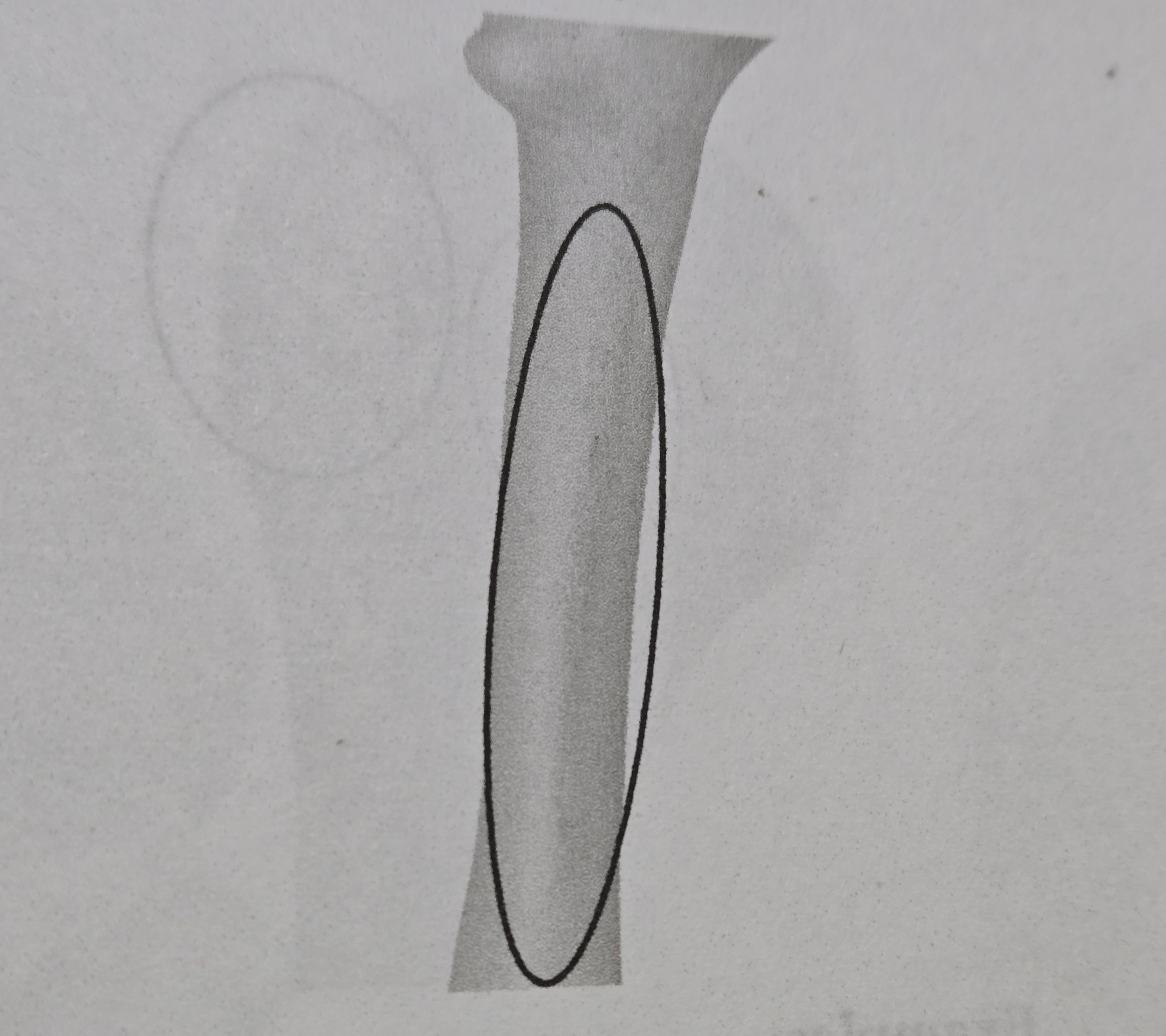 <p>Linea</p>