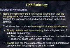 <p>Rapid movement of the brain during trauma tears the bridging veins that extend from the cerebral hemispheres through the subarachnoid and subdural space to the dural sinuses > bleeding in subdural space</p>