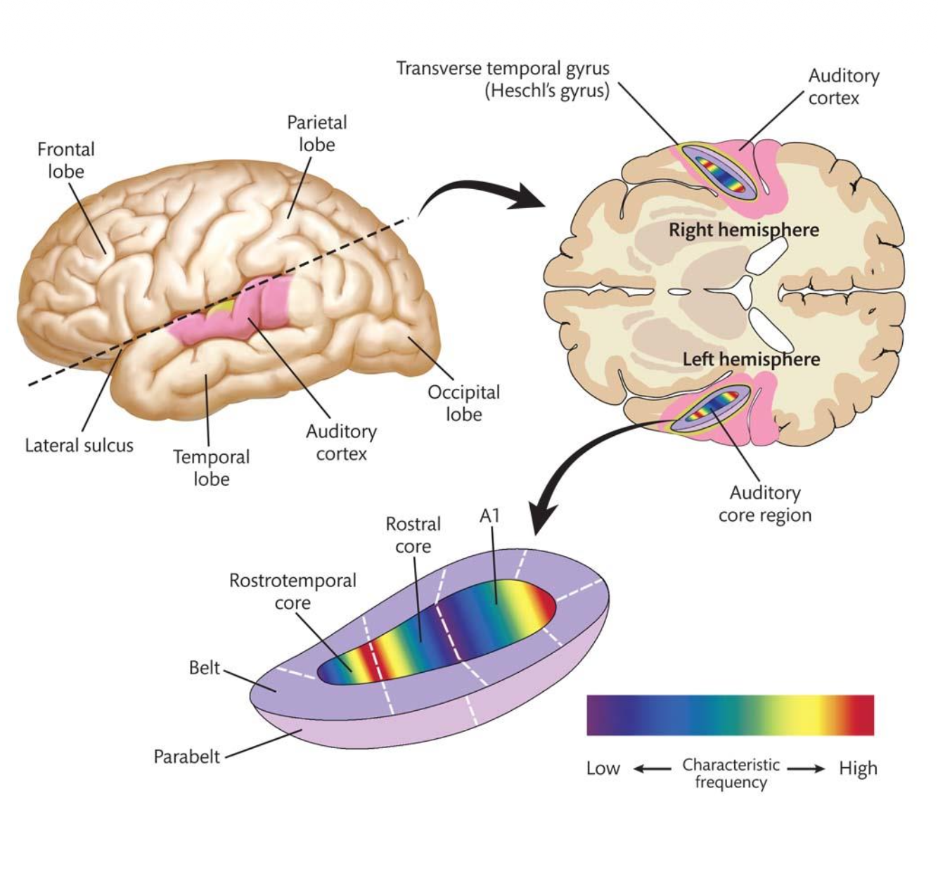 <p><u>Physical Cortical Auditory Pathways – Review</u></p><p><strong>Auditory Cortex has <u>3/4</u> Core Regions.</strong></p><p class="p1">Located in a fissure atop the __.</p><p class="p1">Hierarchical Processing:</p><p class="p1">1. A1 – __(pitch, timing, intensity).</p><p class="p1">2. Belt – <u>Complex/Simple</u> sounds (patterns, voices, rhythm).</p><p class="p1">3. Parabelt– __.</p>