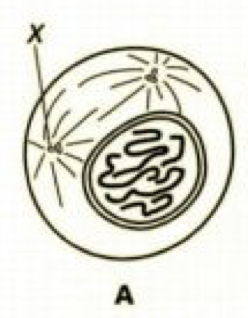 <p>What stage of mitosis is this?</p>