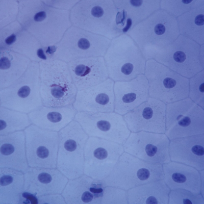 <p>fxn: diffusion, filtration, production of serous fluid</p><p>loc: kidney glomeruli, air sacs of lungs, lining of heart, blood vessels, and lymphatic vessels, serosae</p>