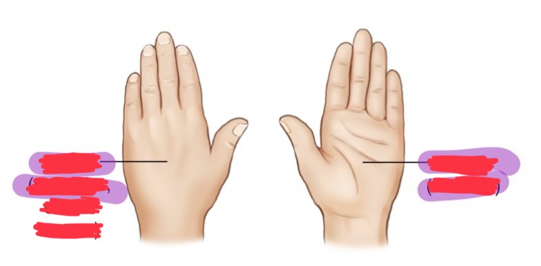 <p>what is the back/posterior of the hand called? (left side)</p>