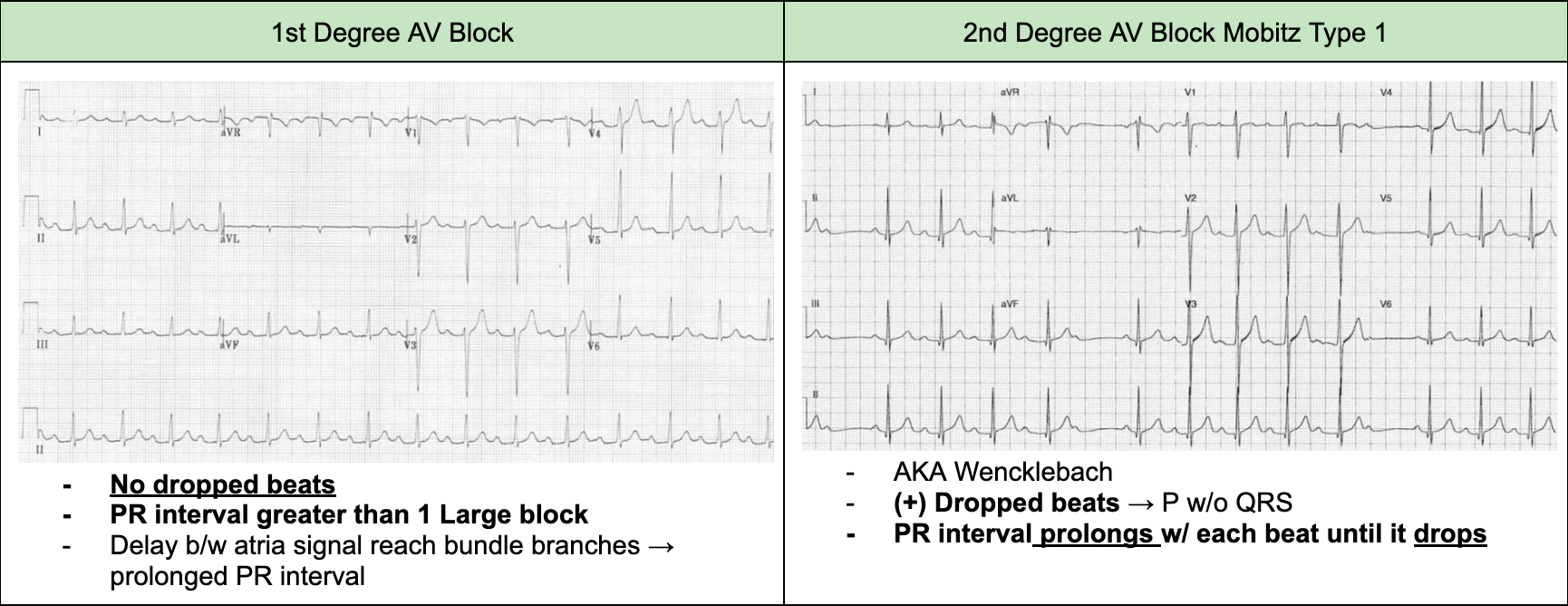 <ul><li><p><span style="background-color: transparent;">Identify and correct any acquired pathogenesis</span></p></li><li><p><span style="background-color: transparent;">Require cardiology consultation if pathological</span></p></li></ul><p></p>