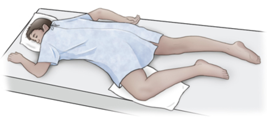<p>semiprone position</p>