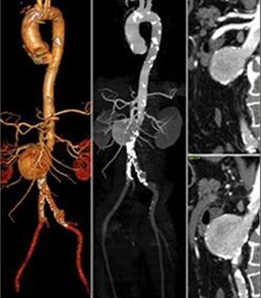 <p>Type of imaging</p>