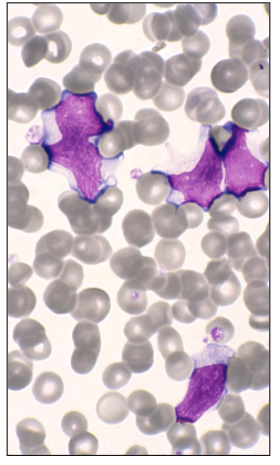 <p>Cytomegalovirus (CMV)</p>