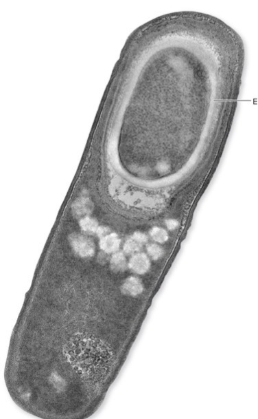 <ul><li><p><strong>Vegetative cell</strong>: metabolically active </p><ul><li><p>When this bacterial cell dies, endospores are released, which are <strong>dormant bodies:</strong> metabolically inactive </p></li></ul></li><li><p>Produced by <em>Bacillus, Clostridium</em>, &amp; <em>Sporosarcina</em></p></li><li><p><strong>Sporulation</strong>: induced by environmental conditions → creation of endospore </p><ul><li><p>To survive environmental stress </p></li></ul></li><li><p>Endospores<strong> resist extremes</strong> of heat, drying, freezing, radiation &amp; chemicals that would kill vegetative cells</p></li><li><p><u>Not meant for reproduction</u> → </p></li></ul><p></p>