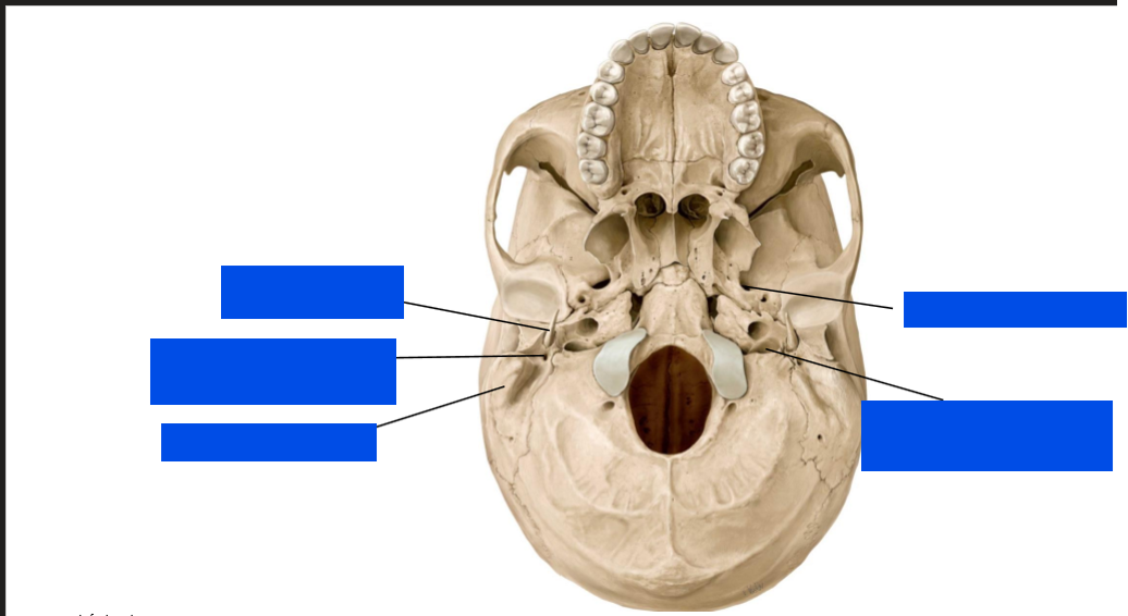 <p>label (with the nerves)</p>