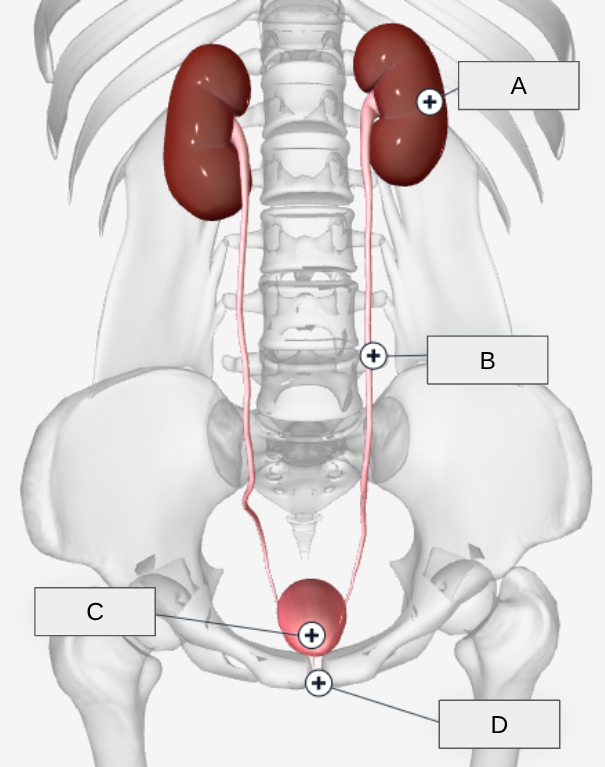 <p>A</p>