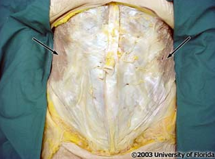 <p>what muscle are the arrows pointing to?</p>