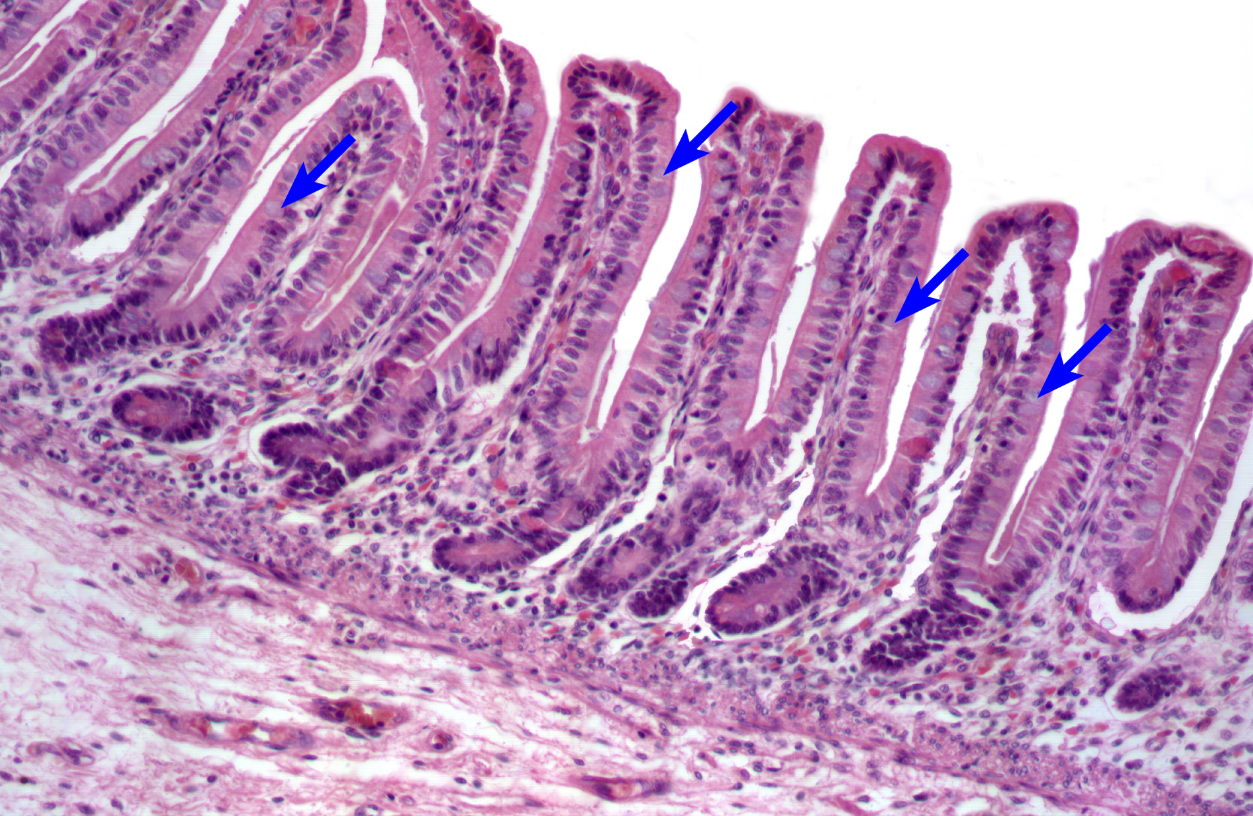 <p>Colon</p><p><strong>NOTICE: THE LARGE NUMBER OF GOBLET CELLS WHICH ARE LIGHTER IN COLOR DUE TO THE WATER CONTENT NEEDED TO PROTECT FROM SOLID WASTE, THE MUCOSA ALSO HAS MORE UNIFORM RIDGES</strong></p>