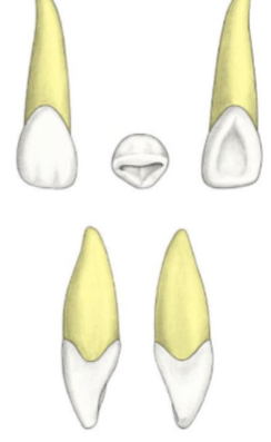 <p>What tooth is this</p>