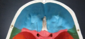 <p>What are these?</p>