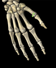 <p>Small bones sometimes found in tendons near joints.</p>