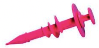 <p><u>Prognosis:</u> Guarded to poor (nerve damage)</p><p><u>Treatment:</u></p><ol><li><p>Treat 1˚ cause if known (eg. bronchopneumonia in calves)</p></li><li><p>Rumenotomy to empty rumen, permanent rumen fistula or red devil trocar (similar to bloat treatment) = Symptomatic treatment</p><ul><li><p><u>Aim:</u> Address stretching of rumen to allow normal contractions to occur</p></li></ul></li></ol><p></p>