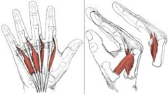<p>> Flex the metacarpophalangeal joint</p><p>> Extend the interphalangeal joints</p>